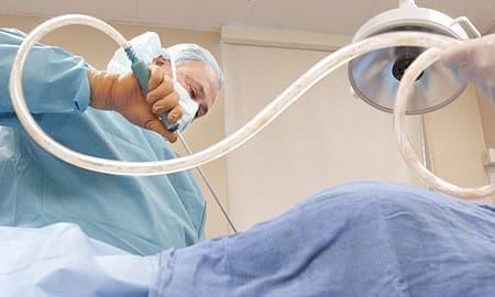 Liposuction is a procedure for removing fat by suction method; photo by Deepak Singh, via Flickr, CC BY 2.0, no changes.
