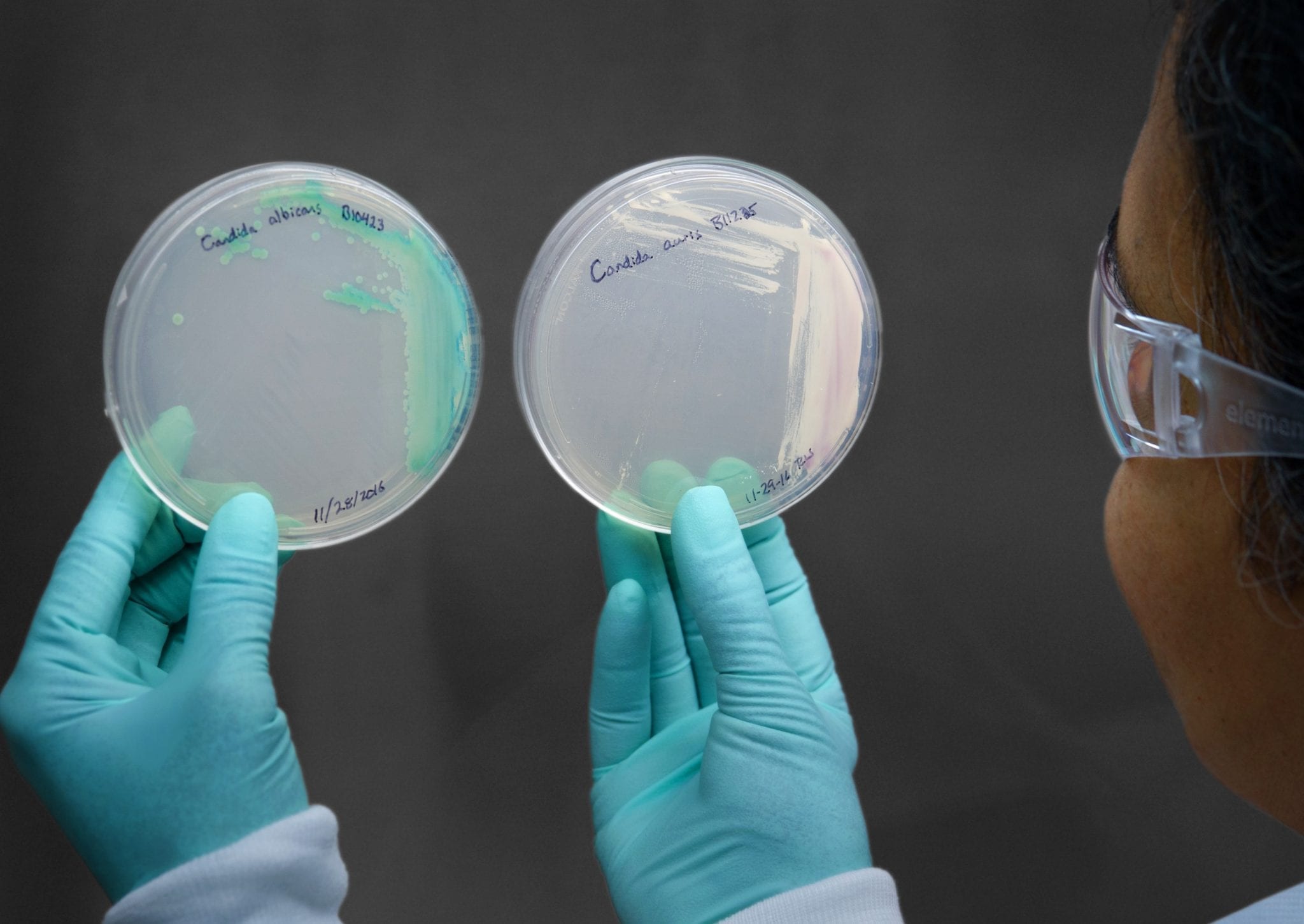 CDC Continues to Warn of Threat Posed By Deadly Fungus Which Thrives in