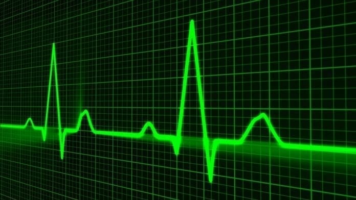 Heartbeat on a monitor; image courtesy of www.usaherald.com.