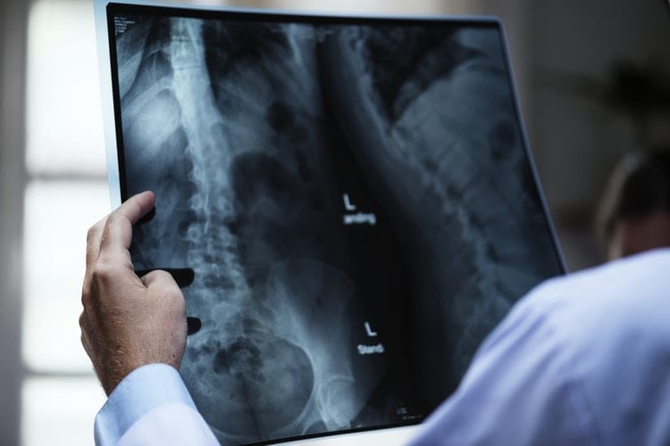 Image of a Doctor Looking at an X-Ray