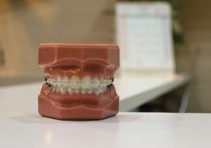 Image of a dental model