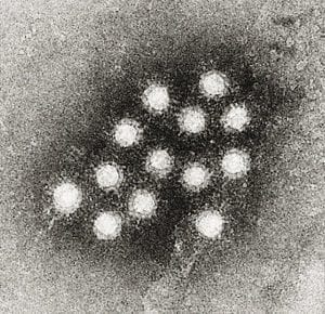 Cropped image of an electron micrograph of the Hepatitis A virus