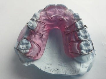 Retainer over plaster cast of teeth, image via Pxhere, CC0.