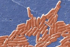 Image of a microscopic view of salmonella