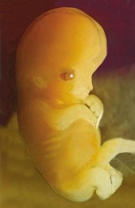 Embryo 7 weeks after conception