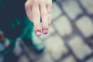 Man extending two injured fingers; image by Markus Spiske, via Unsplash.com.