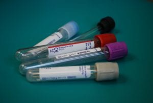 Empty blood collection vials; image by kropekk_pl, via Pixabay.com.