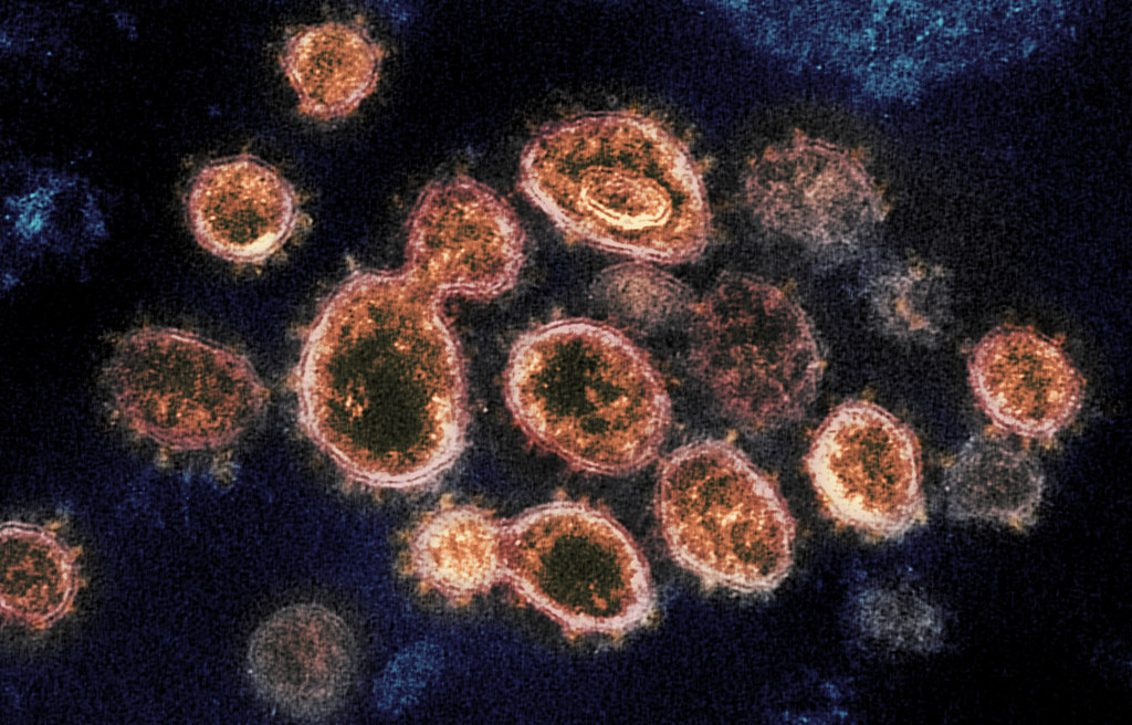Microscopic image of cells with virus particles on the cell surface.