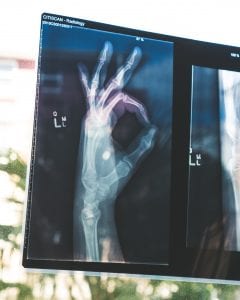 Citiscan imaging result showing hand in the “Okay” sign; image by Owen Beard, via Unsplash.com.