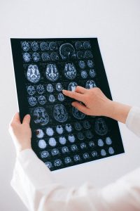 Texas A&M Team Reports Results of Traumatic Memory Reversal Study
