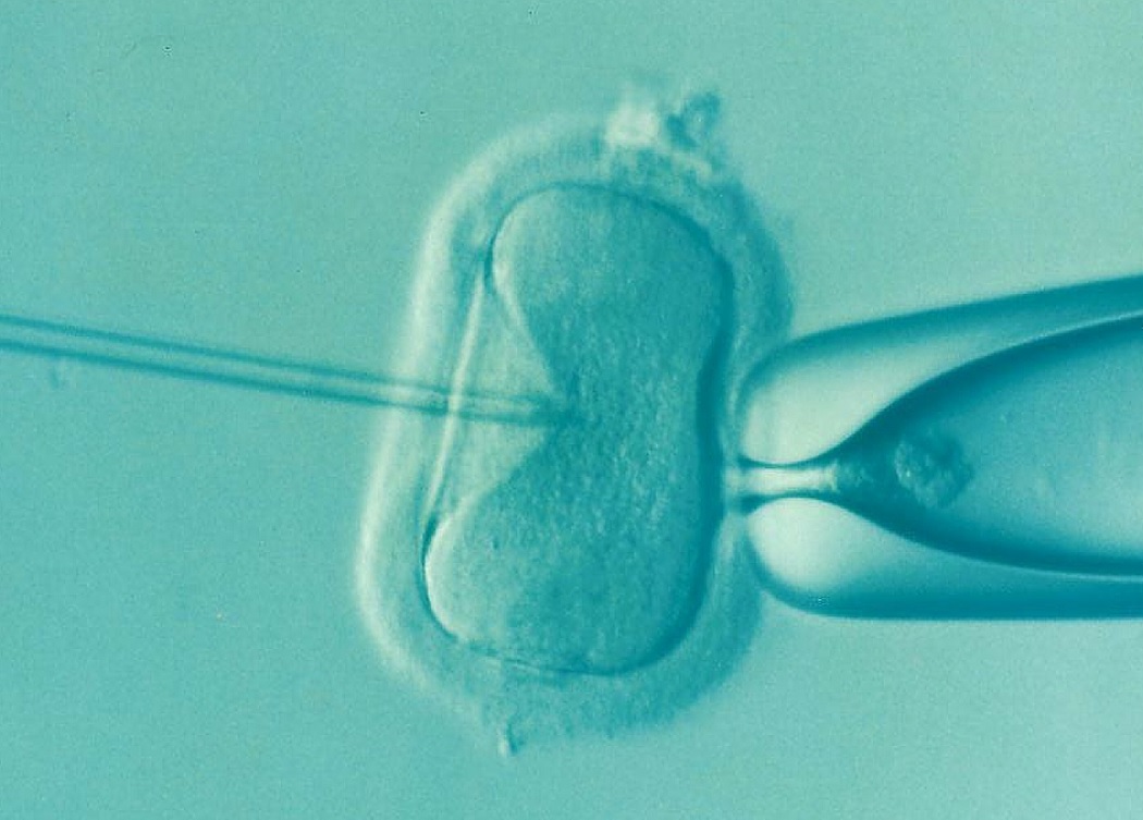Microscopic image of an egg being fertilized during IVF treatment.