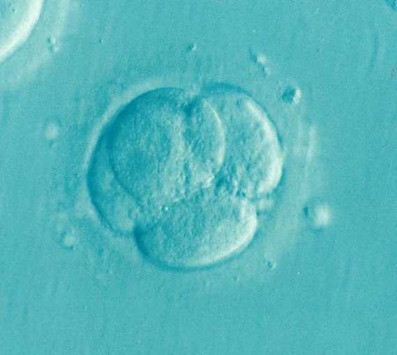 An embryo, only a few cells big.