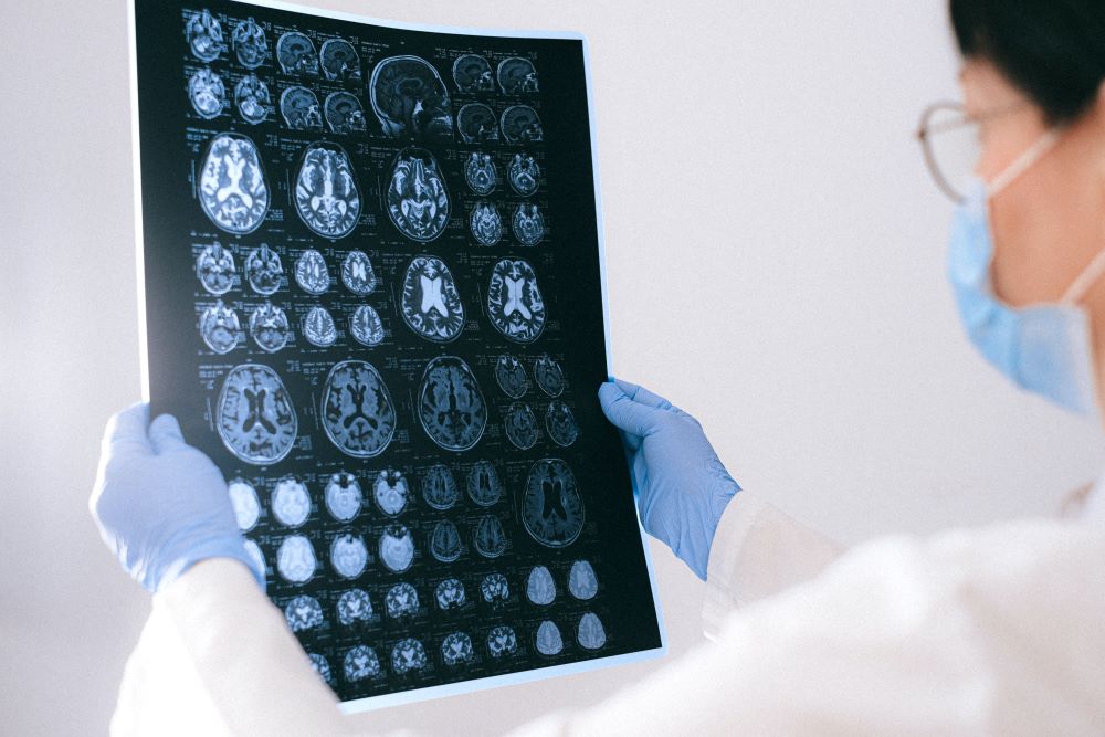 Social Isolation Can Cause Cognitive Decline, Memory Loss