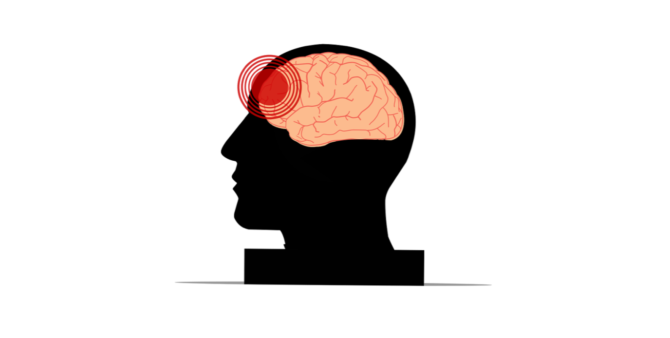 Brain injury graphic; image courtesy of Mohamed Hassan, via Pixabay.com.