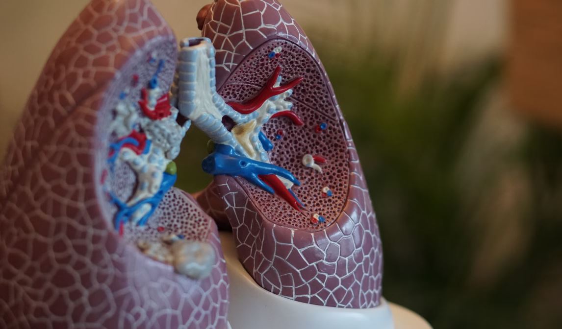 Model of lung anatomy; image by Robina Weermeijer, via Unsplash.com.