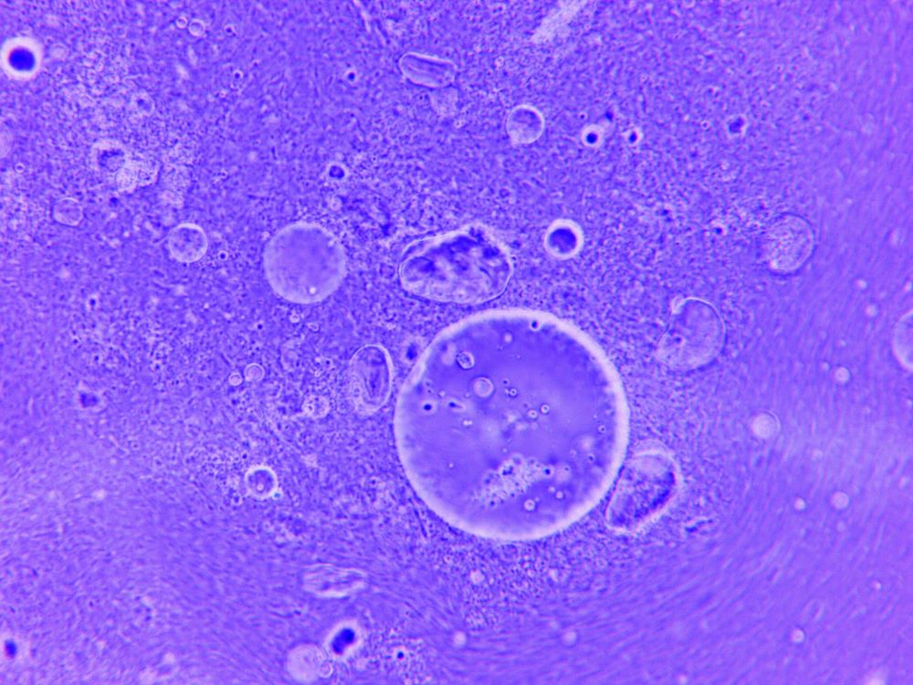 T Cells Offer Hope for Autoimmune Diseases, Transplants
