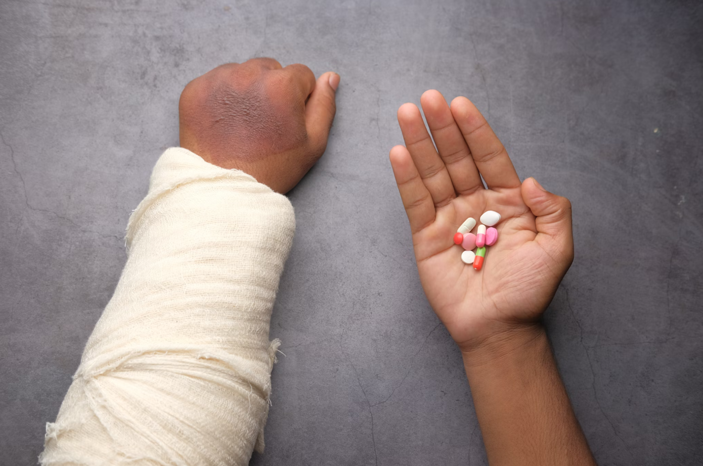 Person in an arm cast with handful of pills in the other hand; image by Towfiqu barbhuiya, via Unsplash.com.