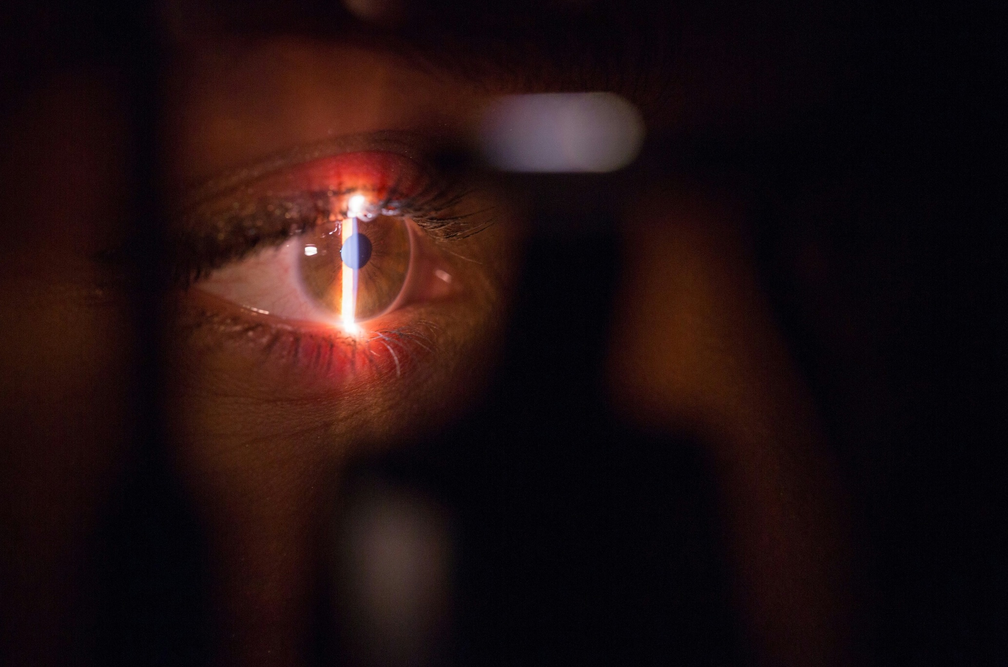 Upclose examination of human eye; image by Brands&People, via Unsplash.com.