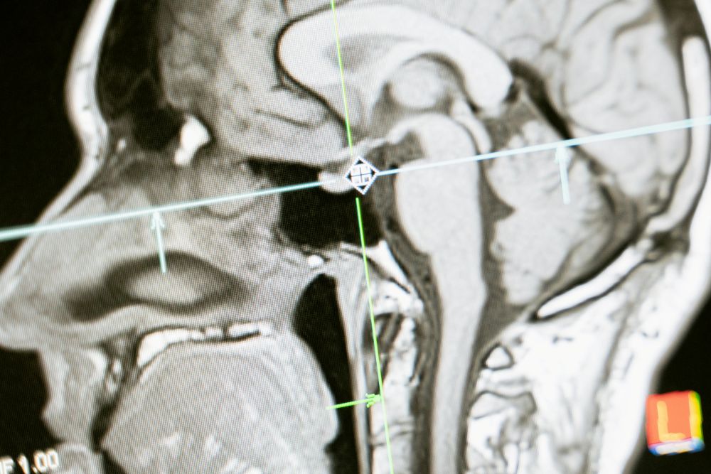 Brain Activity Linked to Emotional Resilience