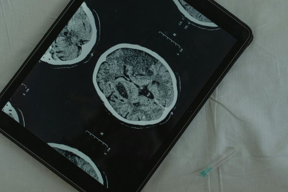 Brain Activity Linked to Emotional Resilience
