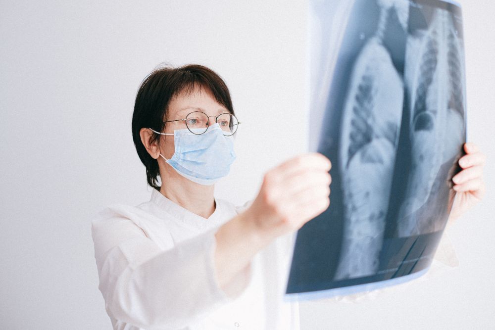 Radiosurgery Linked to Longer Lung Cancer Survival