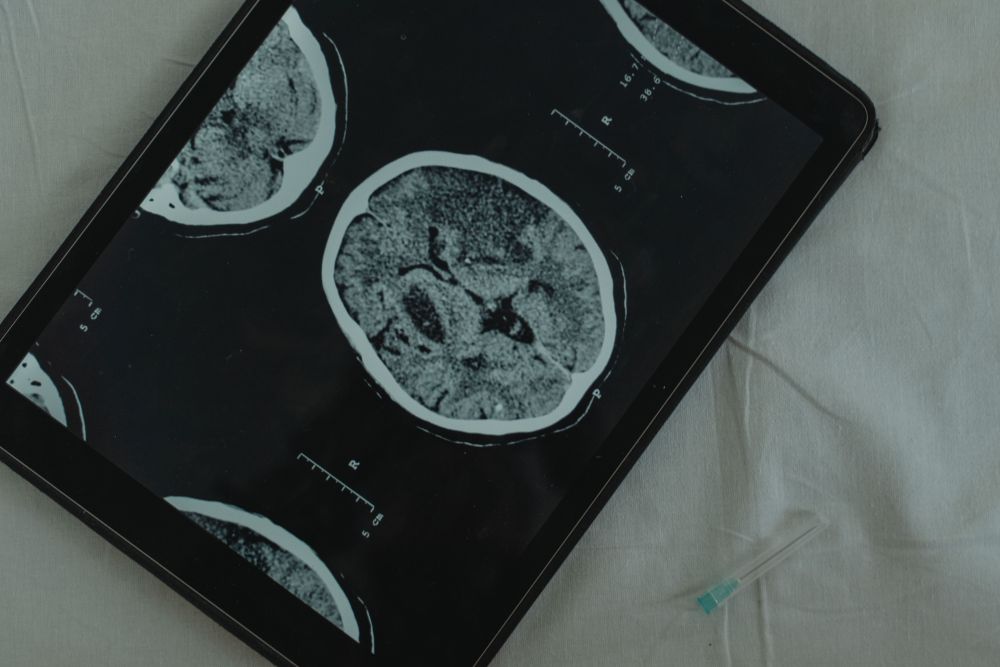 Cortisol Patterns Linked to Cognitive Decline in Older Adults